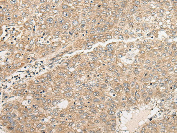 C1orf101 Polyclonal Antibody Reactivity Human