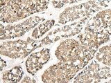 CCDC181 Polyclonal Antibody