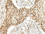 CCDC181 Polyclonal Antibody