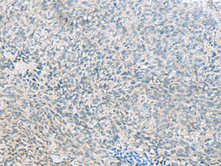 C1orf112 Polyclonal Antibody