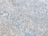 C1orf112 Polyclonal Antibody