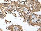 SPRTN Polyclonal Antibody Reactivity Human