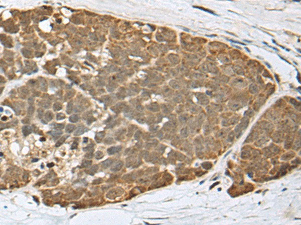 SPRTN Polyclonal Antibody Reactivity Human