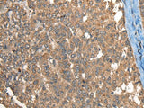 C1R Polyclonal Antibody Reactivity Human