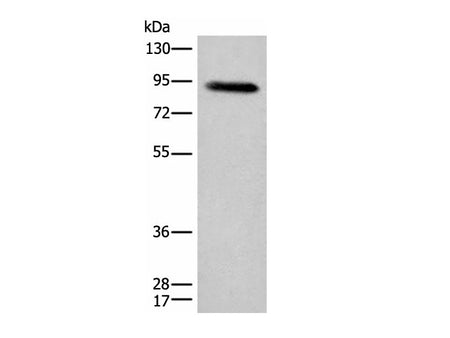 C1R Polyclonal Antibody Reactivity Human