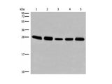 GATD3B Polyclonal Antibody Reactivity Human