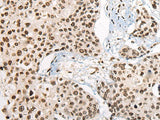 RTCB Polyclonal Antibody Reactivity Human