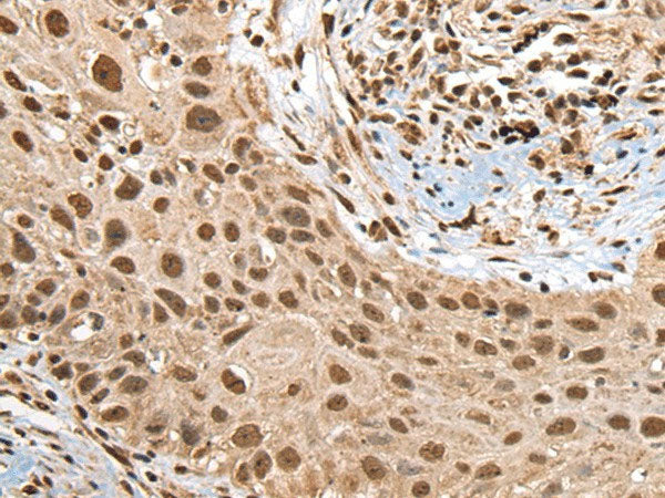 RTCB Polyclonal Antibody Reactivity Human
