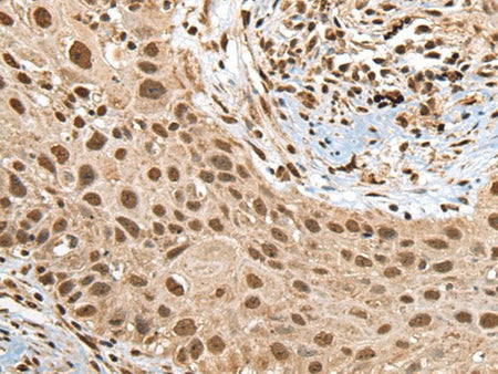RTCB Polyclonal Antibody Reactivity Human