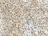 C3orf38 Polyclonal Antibody Reactivity Human