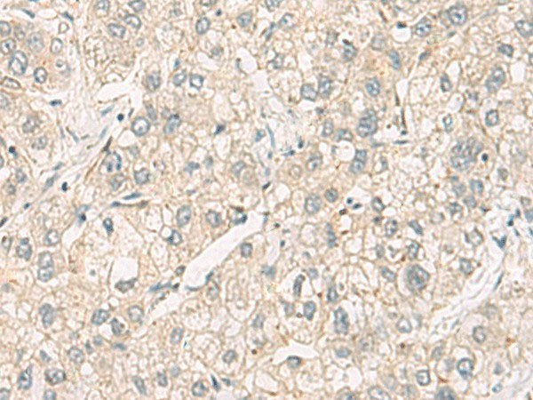C3orf38 Polyclonal Antibody Reactivity Human