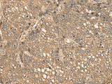 C4BPB Polyclonal Antibody