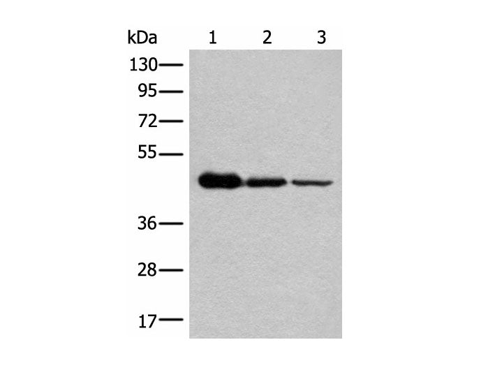 NADK2 Polyclonal Antibody Reactivity Human