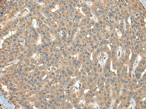 CA7 Polyclonal Antibody Reactivity Human