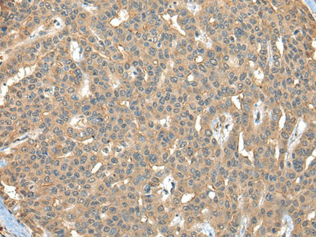 CA7 Polyclonal Antibody Reactivity Human