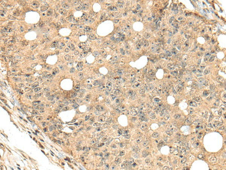 CA7 Polyclonal Antibody Reactivity Human