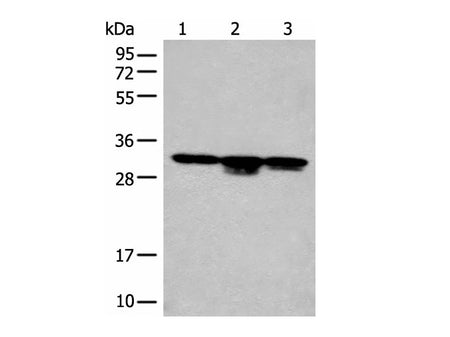 CA7 Polyclonal Antibody Reactivity Human