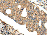PPP3R1 Polyclonal Antibody Reactivity Human