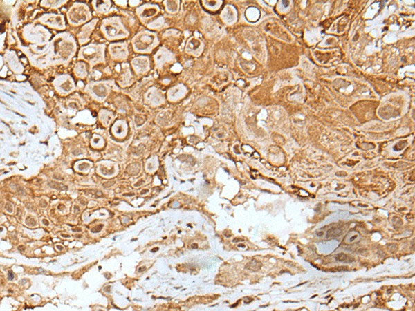 IL6ST Polyclonal Antibody Reactivity Human