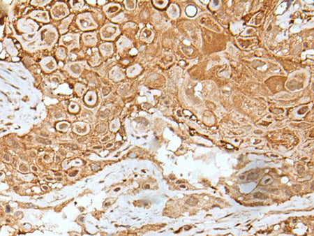 IL6ST Polyclonal Antibody Reactivity Human