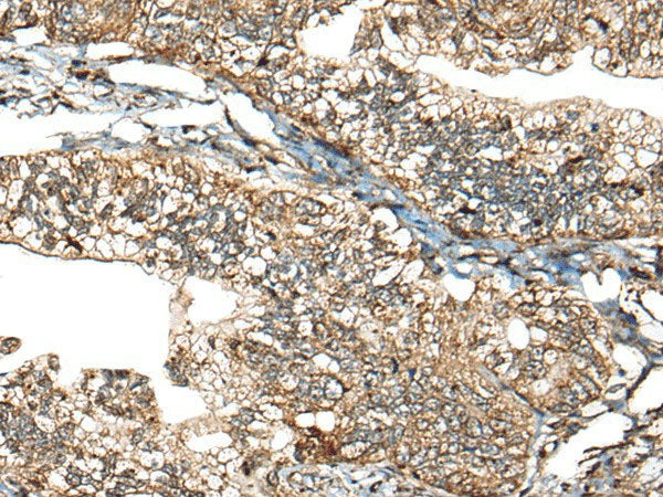CALHM1 Polyclonal Antibody Reactivity Human