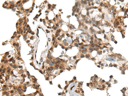 CALML5 Polyclonal Antibody Reactivity Human