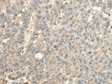 CASQ1 Polyclonal Antibody