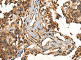 CAMKK1 Polyclonal Antibody Reactivity Human