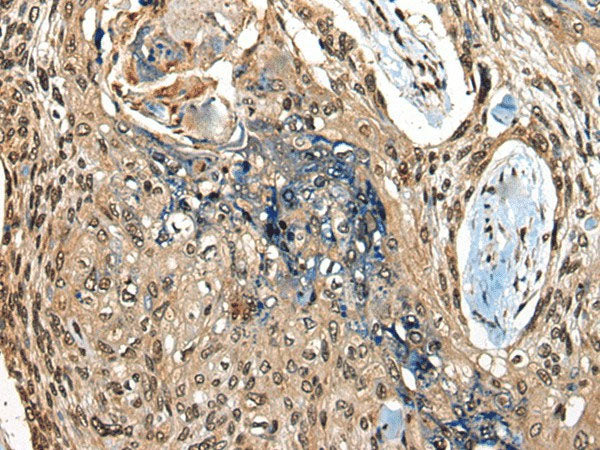 CAMKK1 Polyclonal Antibody Reactivity Human