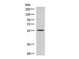 CAMKK1 Polyclonal Antibody Reactivity Human