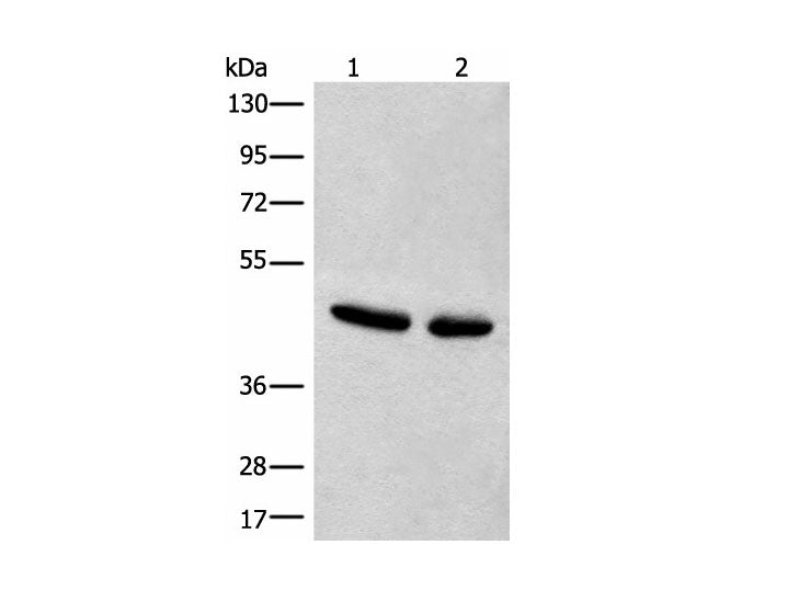 CANT1 Polyclonal Antibody Reactivity Human