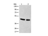 CANT1 Polyclonal Antibody Reactivity Human