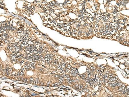 CA11 Polyclonal Antibody Reactivity Human