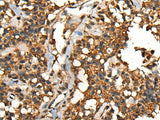 SHPK Polyclonal Antibody