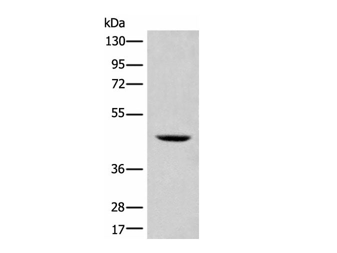 SHPK Polyclonal Antibody