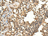 CASK Polyclonal Antibody Reactivity Human