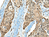 CASK Polyclonal Antibody Reactivity Human