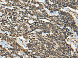 MICU1 Polyclonal Antibody Reactivity Human