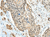 CBFB Polyclonal Antibody