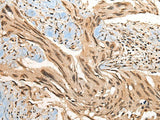 CBFB Polyclonal Antibody