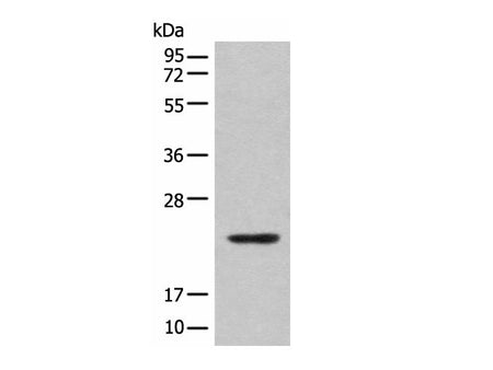 CBFB Polyclonal Antibody
