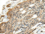 CCDC113 Polyclonal Antibody Reactivity Mouse
