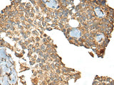 CCDC113 Polyclonal Antibody Reactivity Mouse