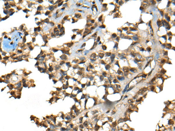 CCDC12 Polyclonal Antibody Reactivity Human