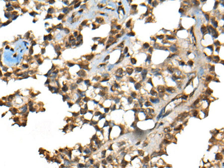 CCDC12 Polyclonal Antibody Reactivity Human