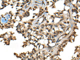 CCDC12 Polyclonal Antibody Reactivity Human