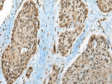 CCDC12 Polyclonal Antibody Reactivity Human