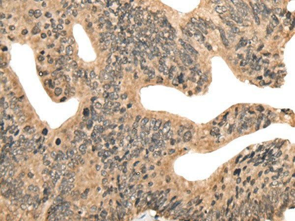 CCNB1IP1 Polyclonal Antibody Reactivity Human