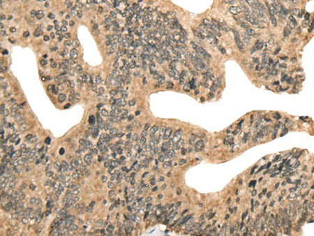 CCNB1IP1 Polyclonal Antibody Reactivity Human