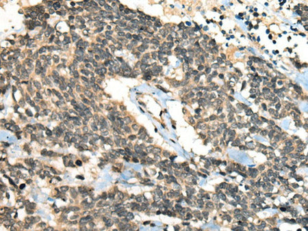 CCNB1IP1 Polyclonal Antibody Reactivity Human